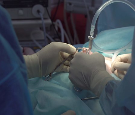 Nurses performing on patient